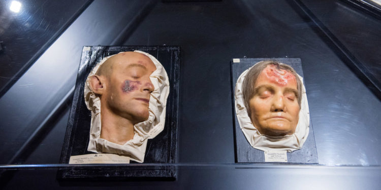 Infekcije sifilisa porast u Njemačkoj – podaci – RT World News