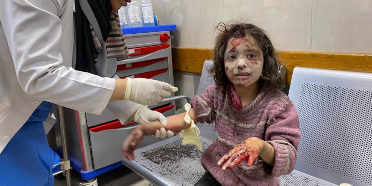 Ozljede civilnih u Gazi slične vojnicima koji se bore protiv ratova, nalaze se