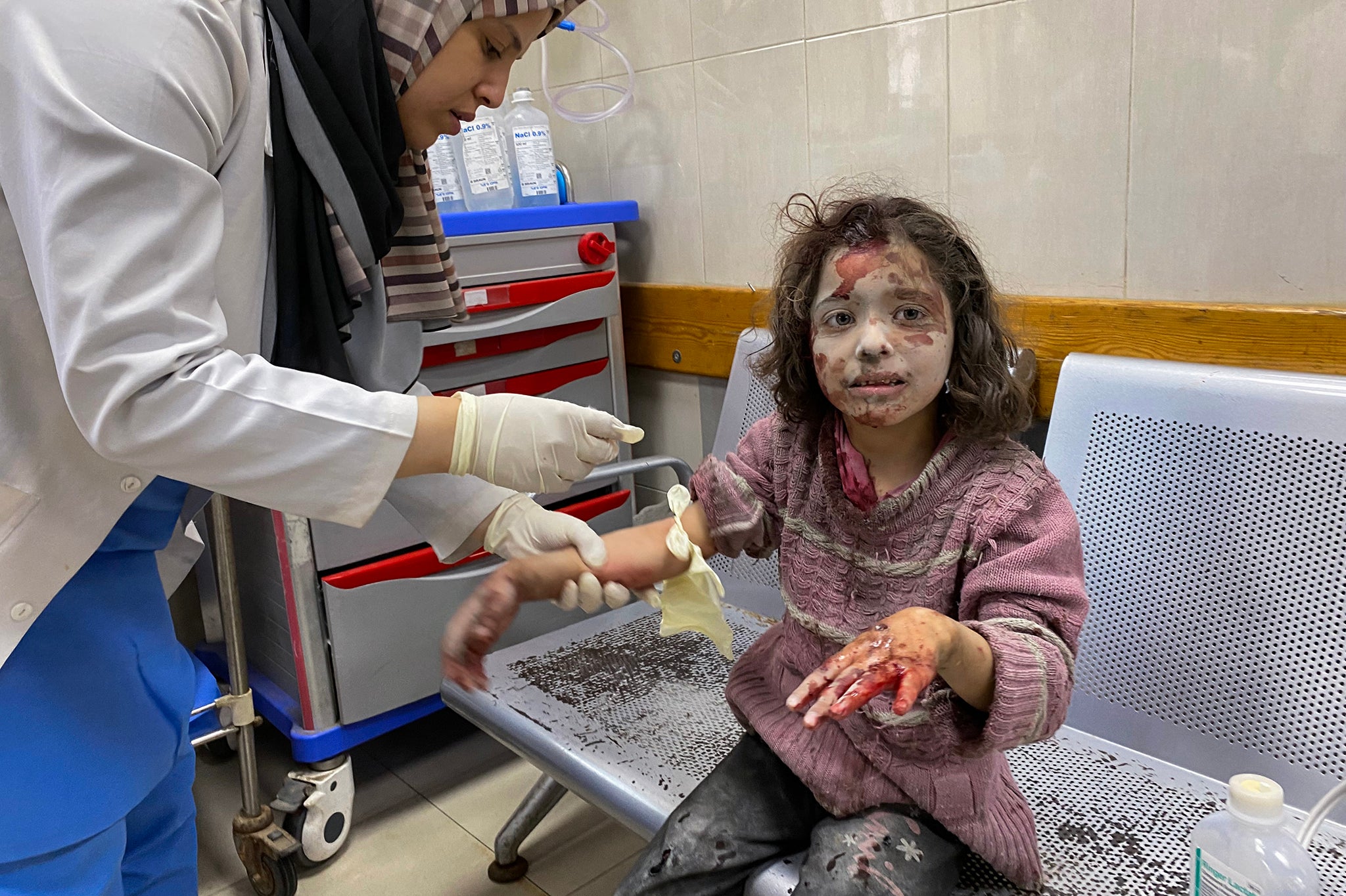 Palestinski liječnik brine djevojku koja je ozlijeđena u izraelskim štrajkovima na raseljavajućim šatorima u Khan Yunisu u lipnju