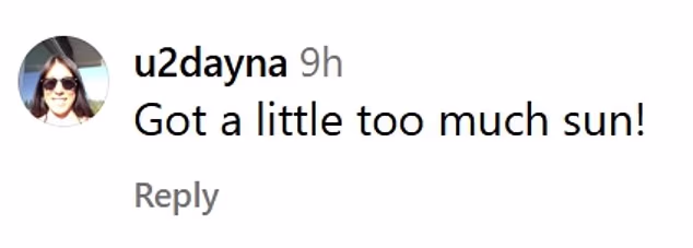 Neki su smatrali da Bradov crveni ten ima veze s opeklinama od sunca