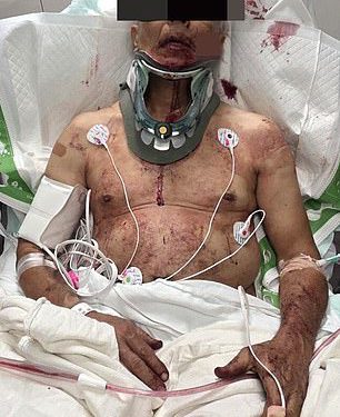 Čovjek koji je ubodio bivšu NFL zvijezdu Mark Sanchez tvrdi da mi je “vjera vodio ruke” dok govori na krvavoj svađi