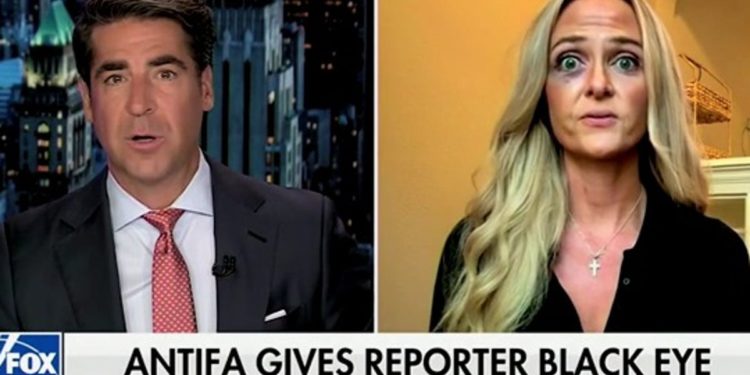 Desničarski novinar kaže Fox Newsu da joj je prosvjednik iz Portlanda “Antifa” dao crno oko