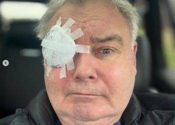 Eamonn Holmes izaziva zabrinutost od obožavatelja i njegovih kolega iz GB News-a dok prolazi postupak očiju u najnovijem neuspjehu za Zdravstvenu zvijezdu