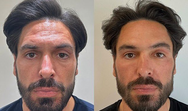 Kako je Mario Falcone postao najzgodniji tata na vratima škole: Bivša zvijezda TOWIE (37) održava mladost dermalnim filerima, tretmanima za lice s lososovom spermom i kemijskim pilinzima