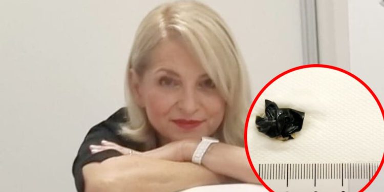 Splitska liječnica pojasnila nevjerojatan slučaj: Kako je dječaku u nos dospjela velika crna stvar?