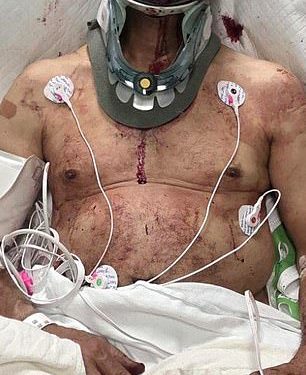 Užasne ubodne rane koje je pretrpio vozač kamiona, 69 godina, ‘Ubod je Mark Sanchez’, a NFL zvijezda suočena s do šest godina zatvora