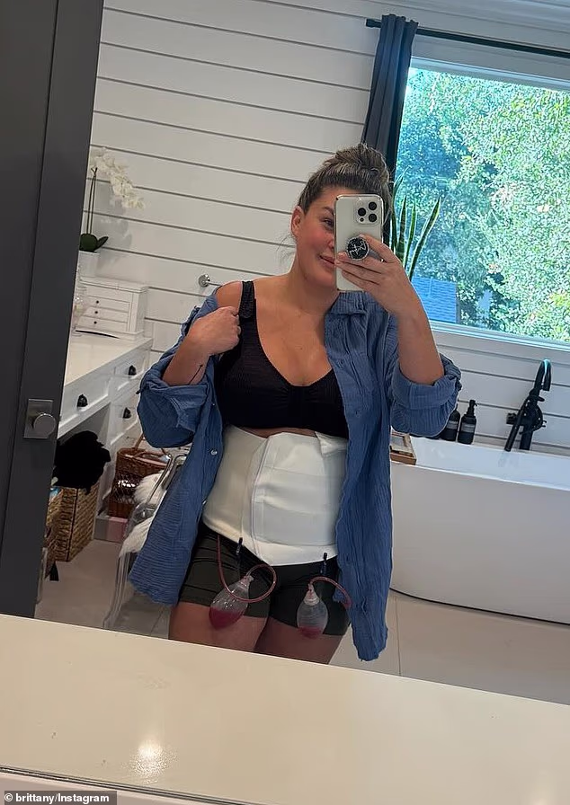 Ovdje se vidi nedugo nakon što je otišla pod nož