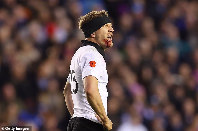 Novi Zeland je i dalje fantastična momčad - a slika zavijenog, okrvavljenog Damiana McKenzieja u punom terminu u Murrayfieldu u subotu navečer sažela je njihov duh nikad ne reci-umri