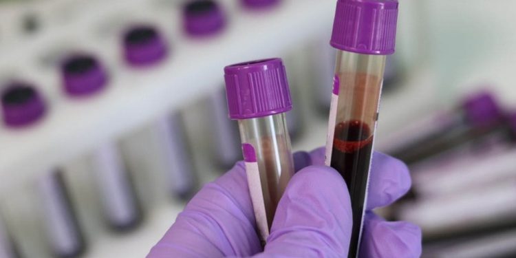 Crveni križ poziva na darivanje krvi u Mertojaku, pridruži se i spasi život