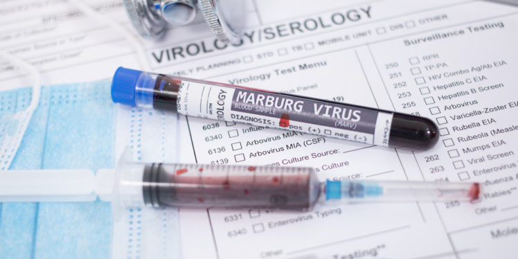 Etiopija potvrdila prvu smrtonosnu epidemiju virusa Marburg — RT Africa