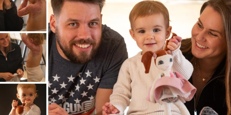 Slobodna Dalmacija – Ljudi, pomozite, KBC Split mora dobiti ovaj uređaj! ‘Naša Tončica ima 18 mjeseci, a zbog liječenja je prešla 43.000 km’