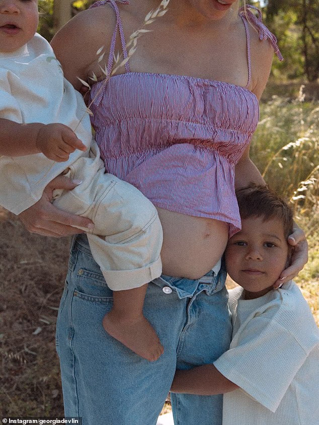 Devlin je u objavi pokazala svoju dječju kvržicu, što je privuklo mnoge poruke podrške i čestitke