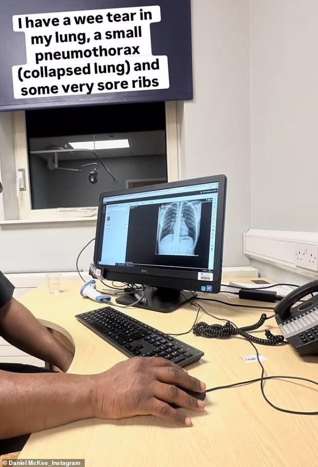 Nastavio je dok je dijelio snimku rendgenske snimke: 'Imam malu poderotinu u plućima, mali pneumotoraks (kolaps pluća) i neka vrlo bolna rebra'