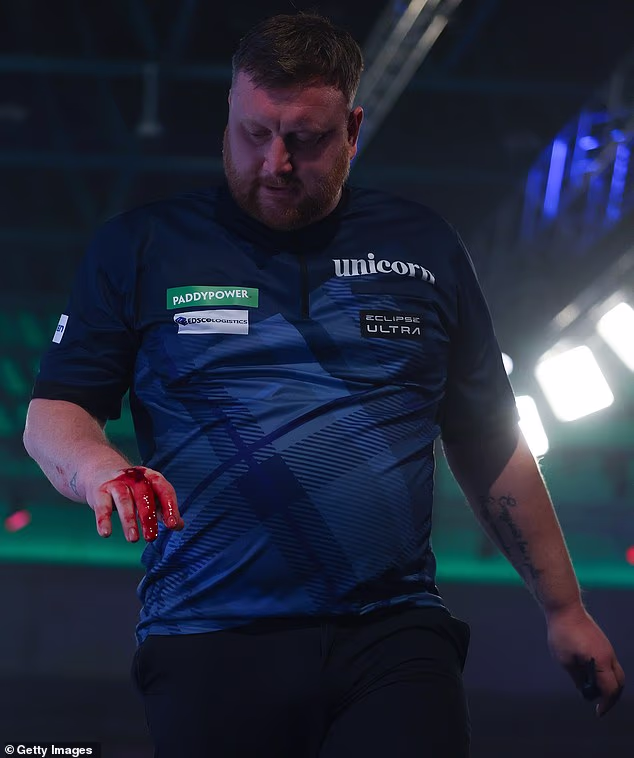 Incident je ostavio Menziesa s krvavom rukom, ali je kasnije otkrio razlog tome