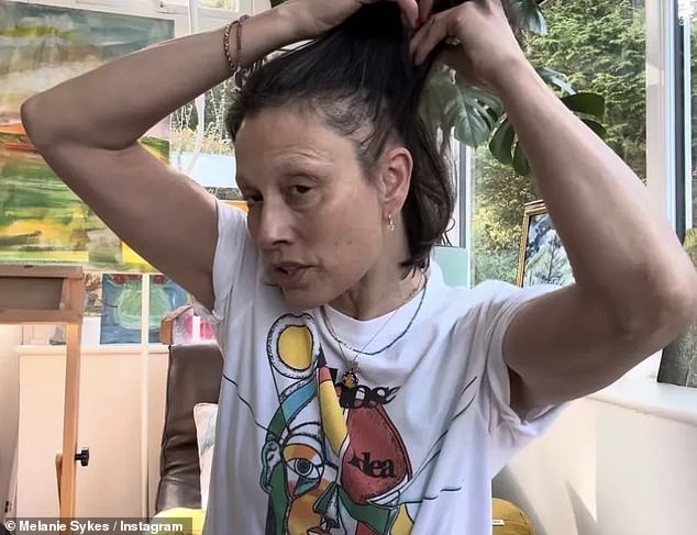 Dala je uvid u svoj gubitak kose u travnju i pokazala profil sa strane, gdje je istaknula ćelavo mjesto na glavi