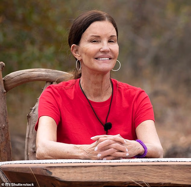 Janice tvrdi da je pretrpjela 'trajne deformacije lica i oštećenje živaca' kad se spotaknula u mraku