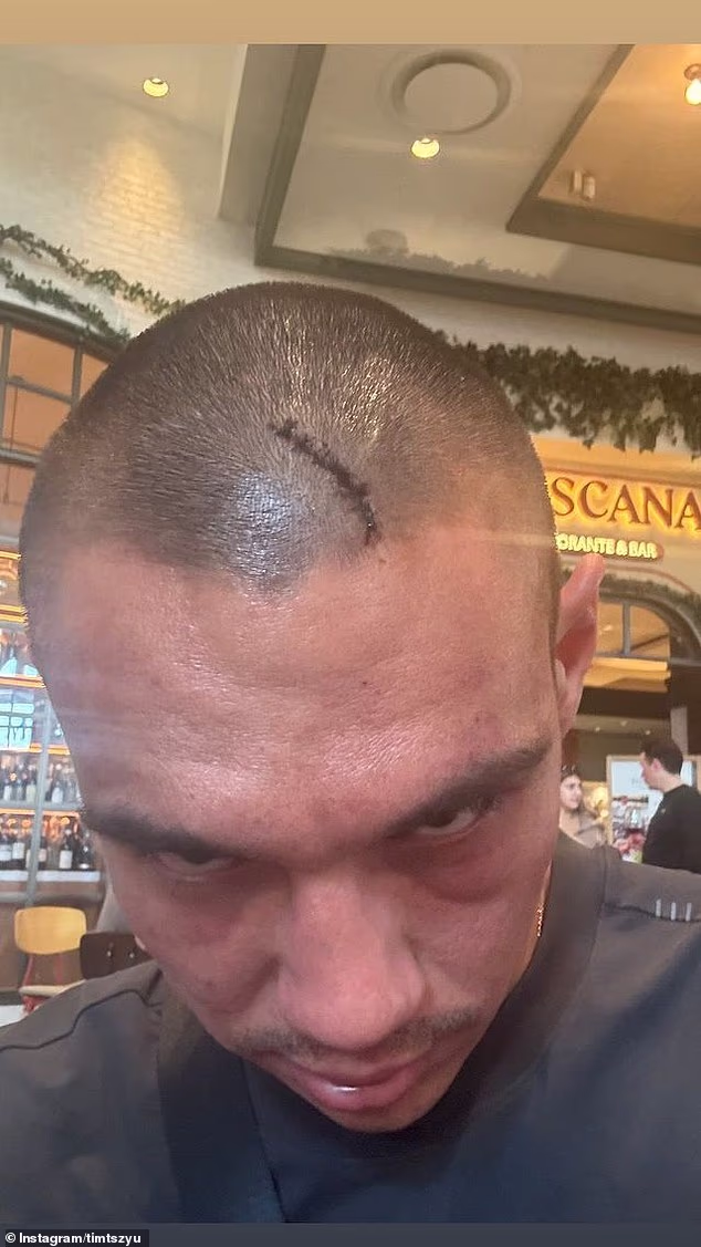 Posjekotina na glavi iz koje je Tim Tszyu prolijevao krv tijekom borbe s Fundorom