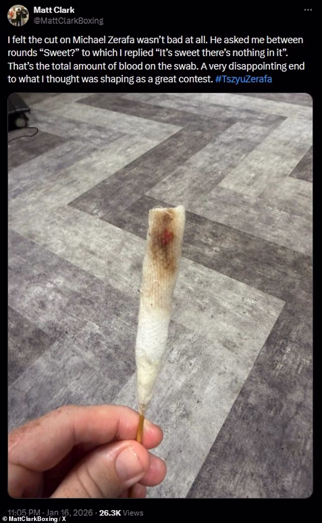 Post na X od Zerafinog posjekotina Matta Clarka inzistirao je na tome da je posjekotina minimalna, prije nego što je podijelio sliku 'krvavog' brisa (na slici)