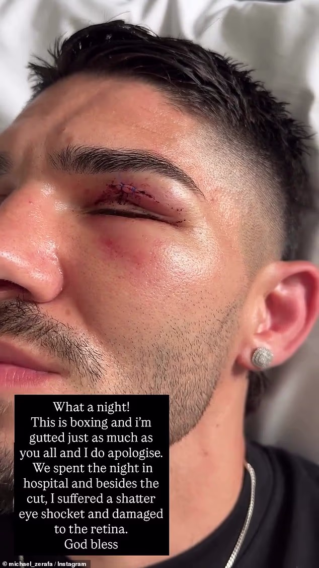 Zerafa, 33, sada tvrdi da je pretrpio 'razbijenu' očnu duplju u borbi koja je senzacionalno prekinuta i proglašena nenatjecanjem - zajedno s oštećenjem mrežnice