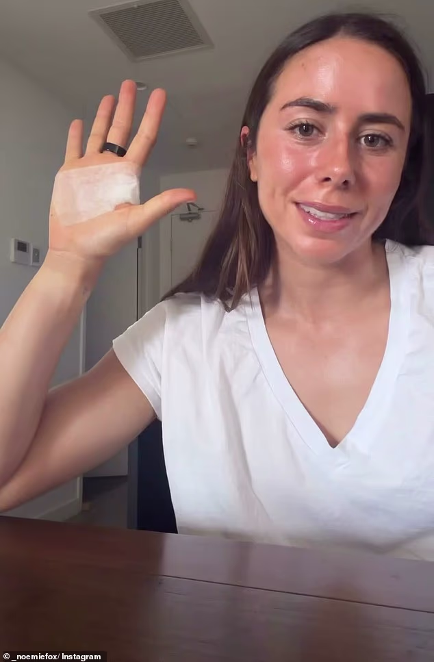 Fox (na slici) je pokazala oštećenje svoje ruke u incidentu