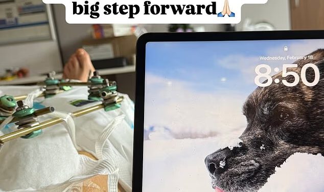 Lindsey Vonn dijeli nervoznu objavu dok čeka petu operaciju slomljene noge nakon olimpijskog pada i smrti psa