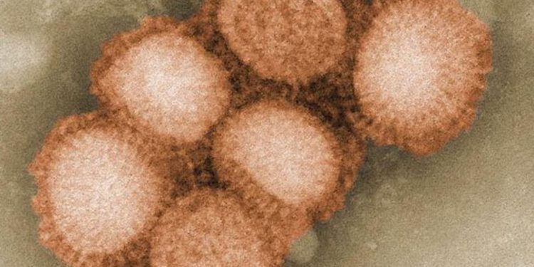 Španjolska je prijavila sumnju na prijenos svinjske gripe s čovjeka na čovjeka