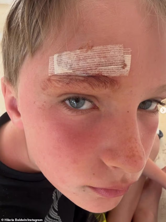 Zatim je otkrila da je jedno od djece doživjelo nesreću na putovanju: 'Upozorenje: Leo je raskolio čelo i dobro smo zbrinuti u bolnici.' Ali sve je ispalo dobro nakon što su klinca previli