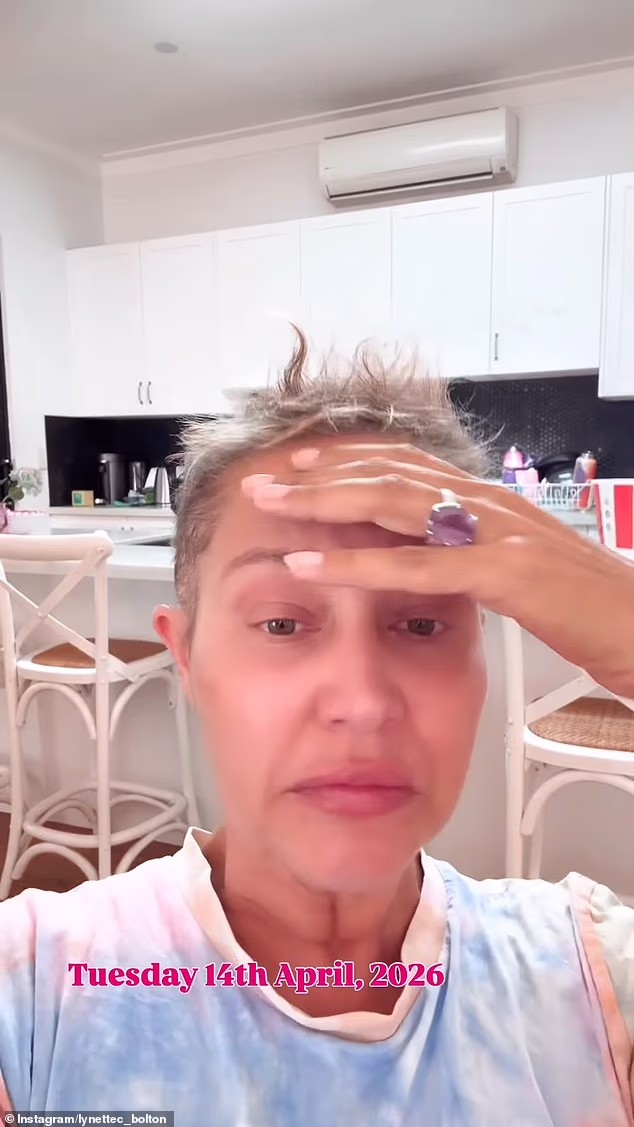 Lynette je objasnila svoj gubitak kose nakon kemoterapije, rekavši da je tretman poznat kao Crveni vrag konačno zaživio