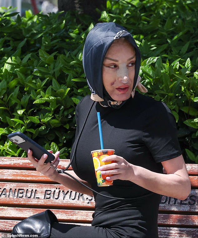 Prošlo je samo 10 dana otkako je Nadia ponovno otišla pod nož, nakon operacije želučanog rukavca 2024. godine, zbog koje je odustala od 10 brojeva haljina