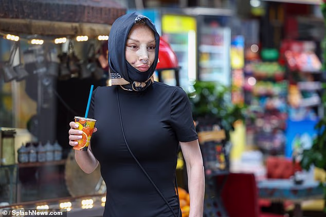 Nadia je nosila svilenu maramu koja joj je pokrivala veći dio lica, dok joj je nos bio zalijepljen flasterom
