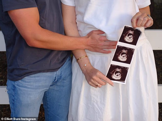 Jedna slika prikazuje Leva kako stavlja jednu ruku na bujajuću kvržicu 25-godišnje Elliott dok je predstavljala sonogram sićušnog fetusa