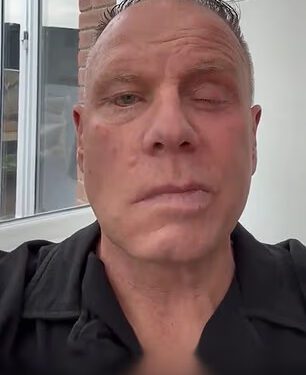 Bivši kapetan Man Cityja (55) otvorio je bitku za zdravlje nakon što mu je dijagnosticirano razorno neurološko stanje