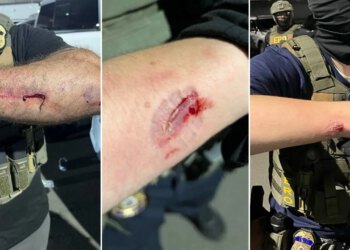 DOJ optužuje izgrednika iz Newarka za napad na službenike ICE-a u pritvorskom centru