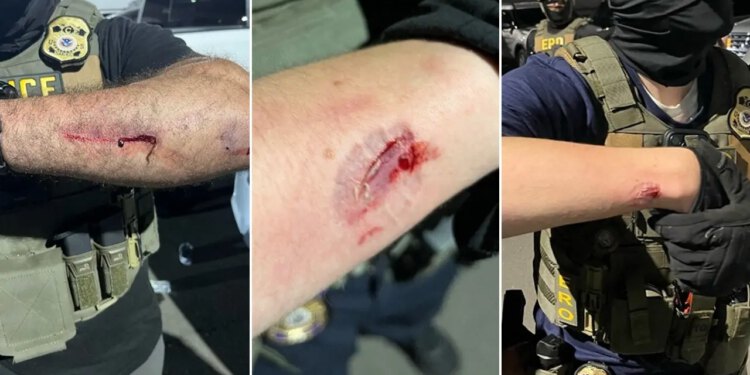 DOJ optužuje izgrednika iz Newarka za napad na službenike ICE-a u pritvorskom centru