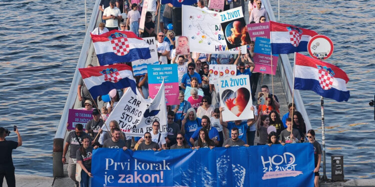 Danijeli u trudnoći rekli da dijete ima sindrom nespojiv sa životom: Ona odlučila roditi