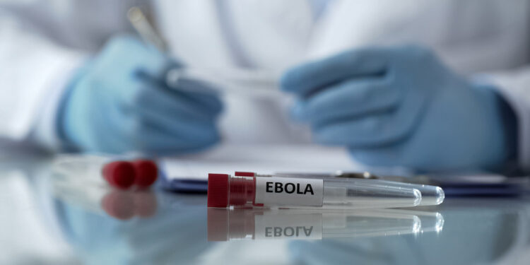 Moskva će pomoći afričkoj državi u borbi protiv epidemije ebole — RT Africa