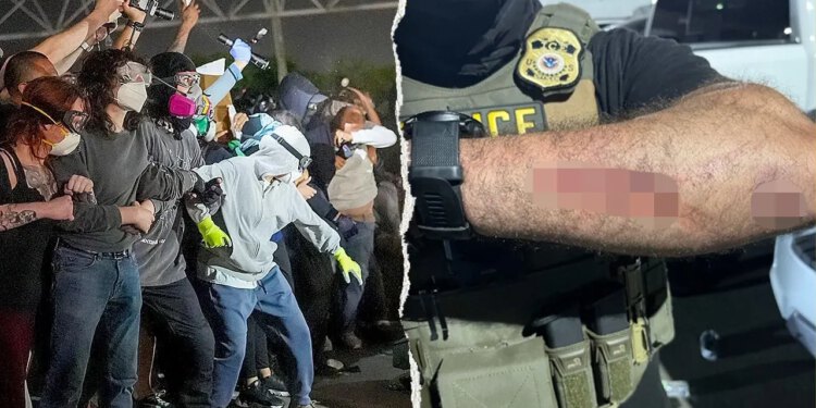 Muškarac iz New Jerseyja uhićen jer je navodno ugrizao službenike ICE-a na prosvjedu u Newarku