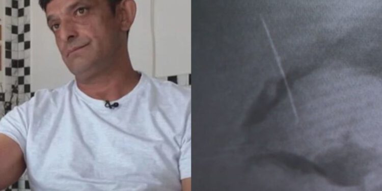 Štefek iz Kutine 10 godina trpio užasne bolove, pogledajte što su mu pronašli u tijelu