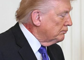 Trumpovo najnovije zdravstveno izvješće kaže da mora smršaviti – ali izostavlja jedan značajan medicinski problem