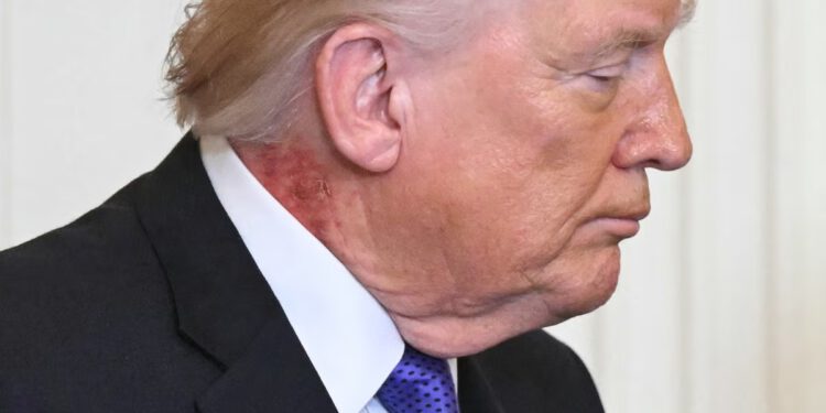 Trumpovo najnovije zdravstveno izvješće kaže da mora smršaviti – ali izostavlja jedan značajan medicinski problem