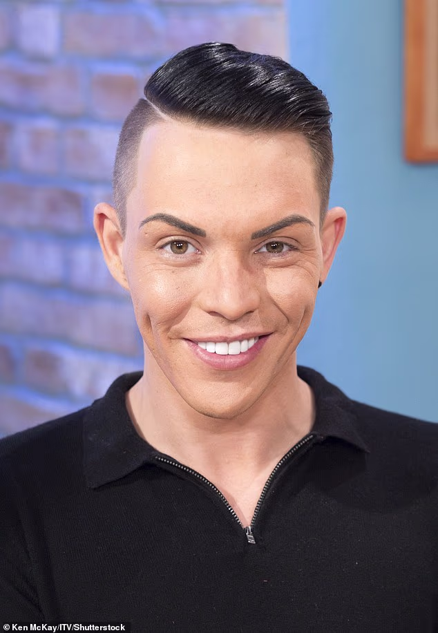 Bivša zvijezda TOWIE otkrila je prošli mjesec da je potrošio više od 50.000 funti na filere prije faceliftinga (na slici 2015.)