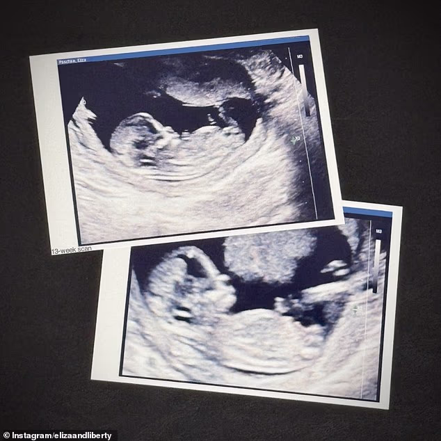 Zvijezda Blocka u četvrtak je na Instagramu objavila sonogram svoje malene bebe, navodeći da je trudna 16 tjedana