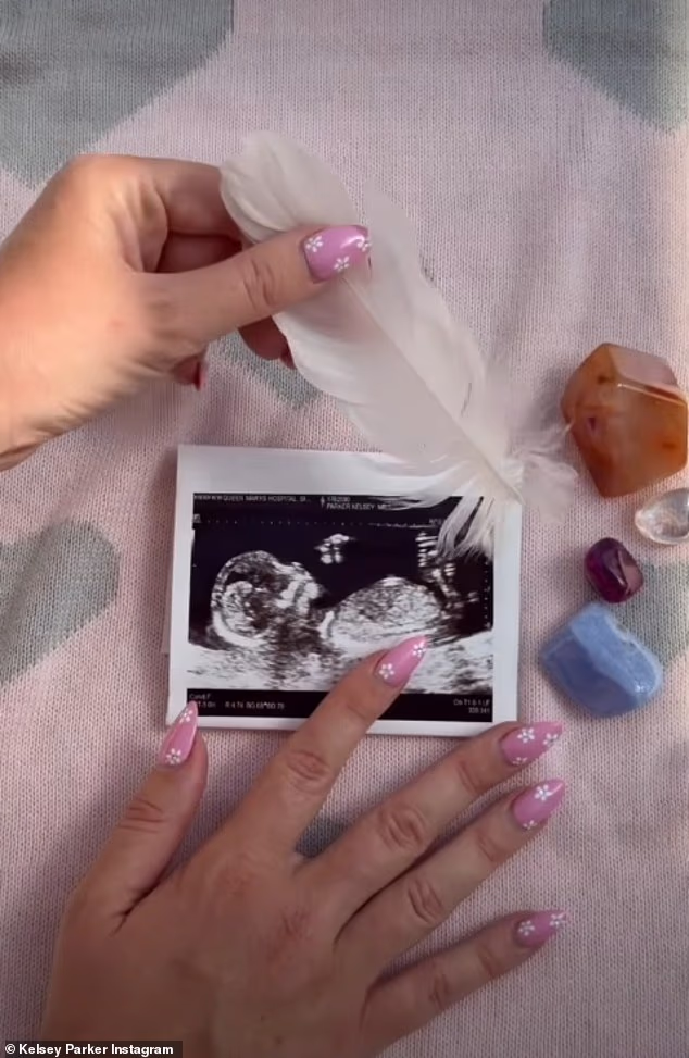 Kelsey je govorila kako joj 'jako nedostaje' njezin sin, ali je 'uzbuđena zbog ovog sljedećeg poglavlja' jer očekuje 'dugino dijete' sa svojim partnerom, Willom Lindsayem (na slici njihova objava)