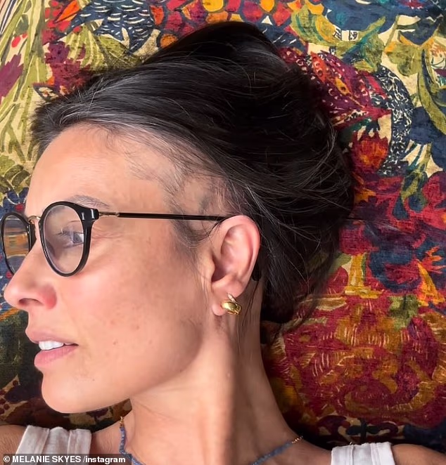 Melanie je isječak na kojem se vidi njezin gubitak kose naslovila '#Liberty'