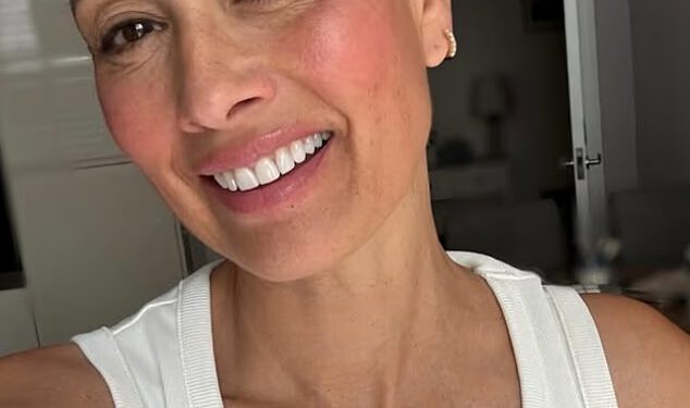 Melanie Sykes ponosno pokazuje svoju ćelavu glavu nekoliko dana nakon što je priznala da je izgubila ‘dvije trećine’ kose tijekom mučne borbe s alopecijom