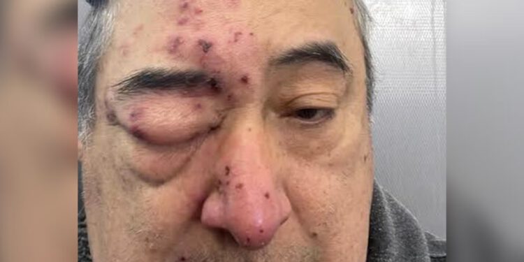 Muškarac iz Chicaga probudio se u svom domu sa štakorom koji mu je ‘žvakao lice’ nakon što se požalio na zarazu