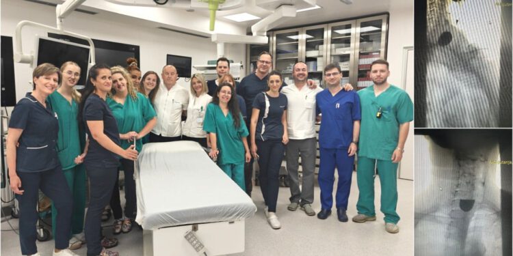 Zavod za gastroenterologiju KBC-a Split uveo novu endoskopsku metodu liječenja