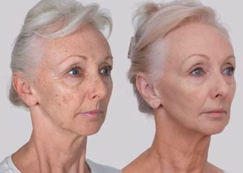Debbie McGee, 67, otkriva rezultate svog nekirurškog liftinga lica koji je ‘promijenio život’ i kaže ‘Izgledam bolje nego u svojim 40-ima’