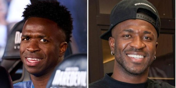 Vinicius Jr je neprepoznatljiv nakon operacije harmonizacije lica