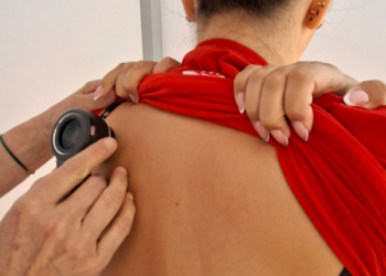 Besplatni dermatološki pregledi u Dubrovniku: Evo kada i gdje možete pregledati madeže